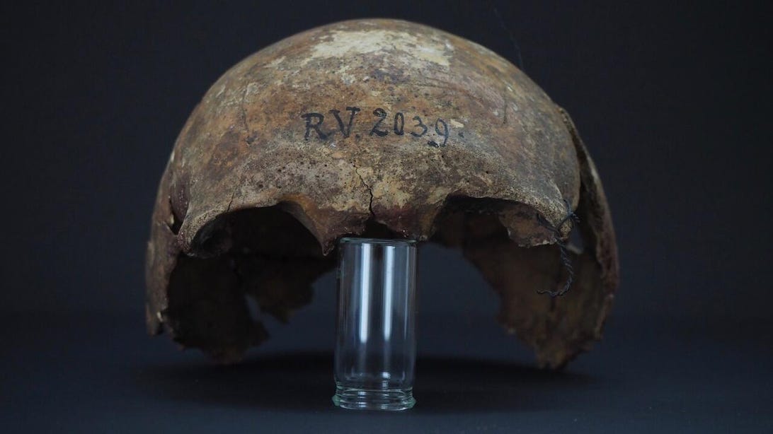 skull of 5,000-year-old man who died of plague