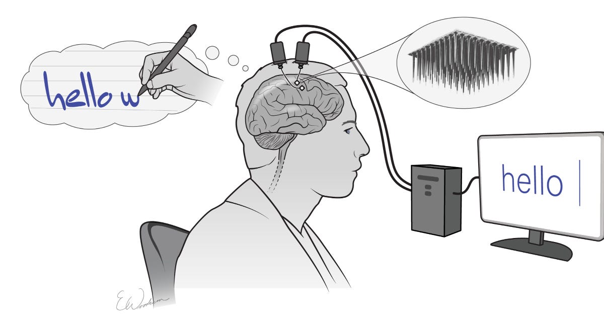 Les implants cérébraux permettent à une personne paralysée du cou vers le bas d’écrire avec seulement des pensées