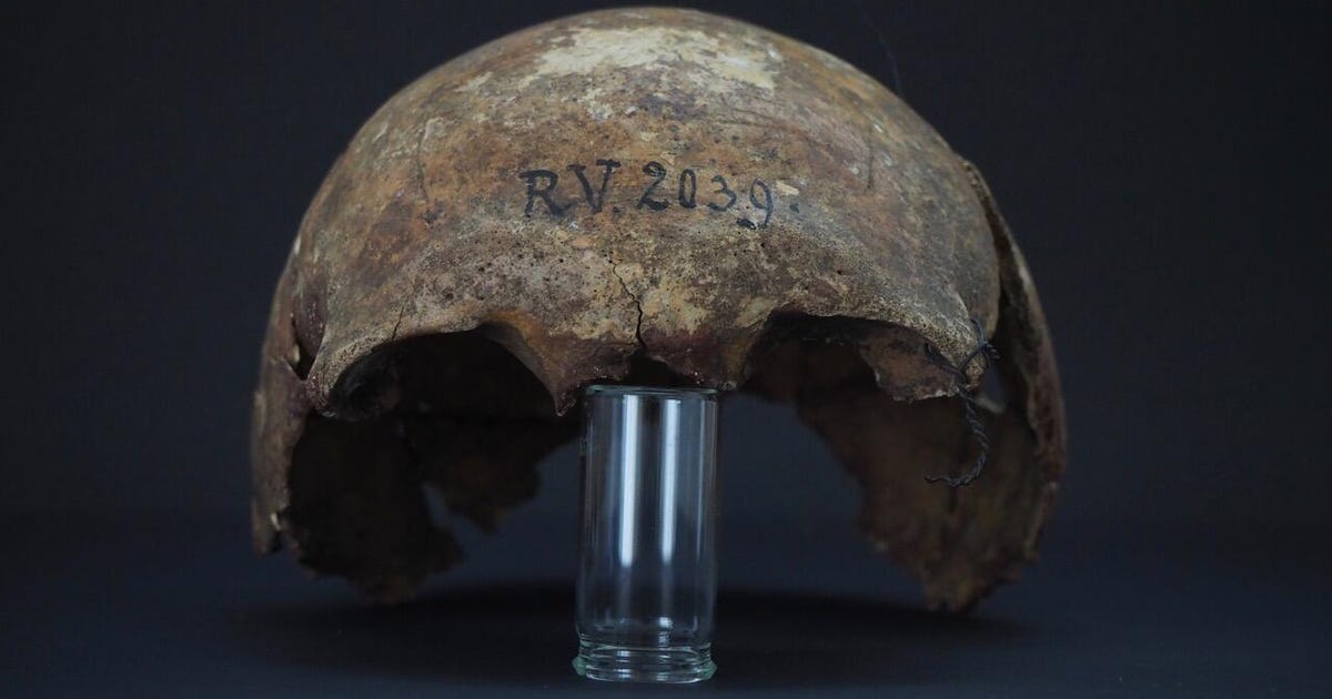 Zinātnieki ir atklājuši 5000 gadus vecu mēra upuri: viņš, iespējams, nomira lēnā nāvē