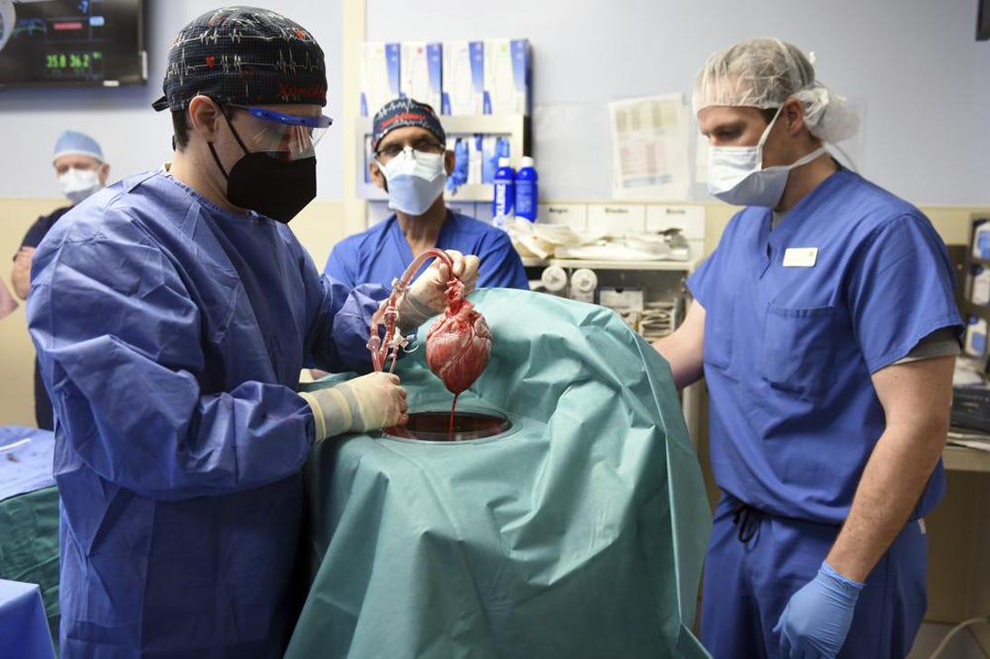 heart-transplant-surgery2