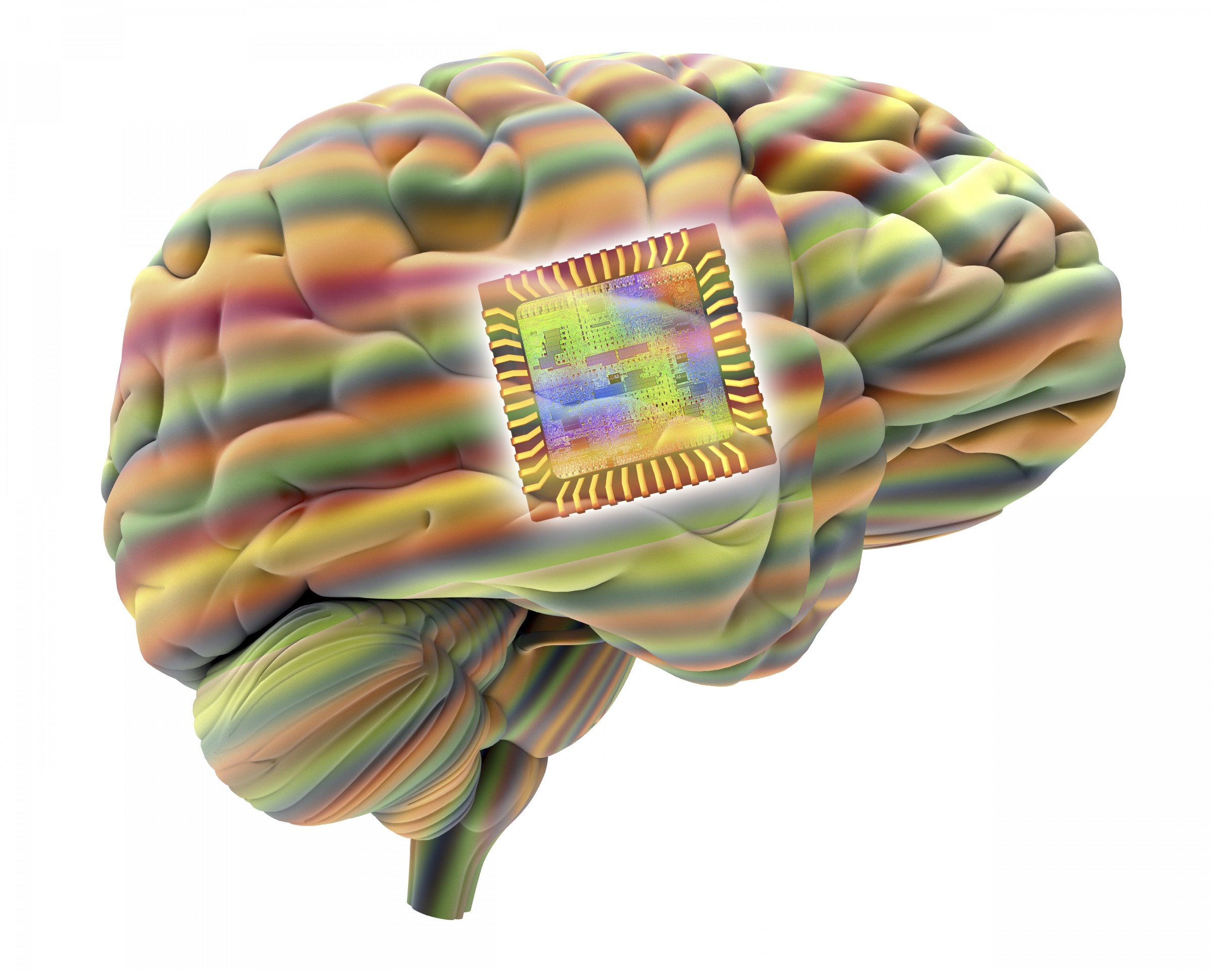 Illustration of brain with implanted chip