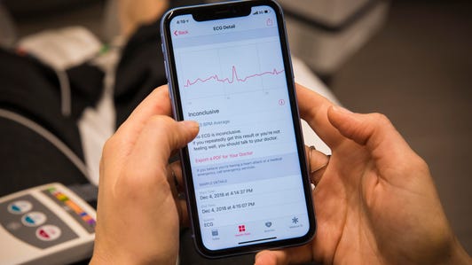 Apple Watch electrocardiogram EKG