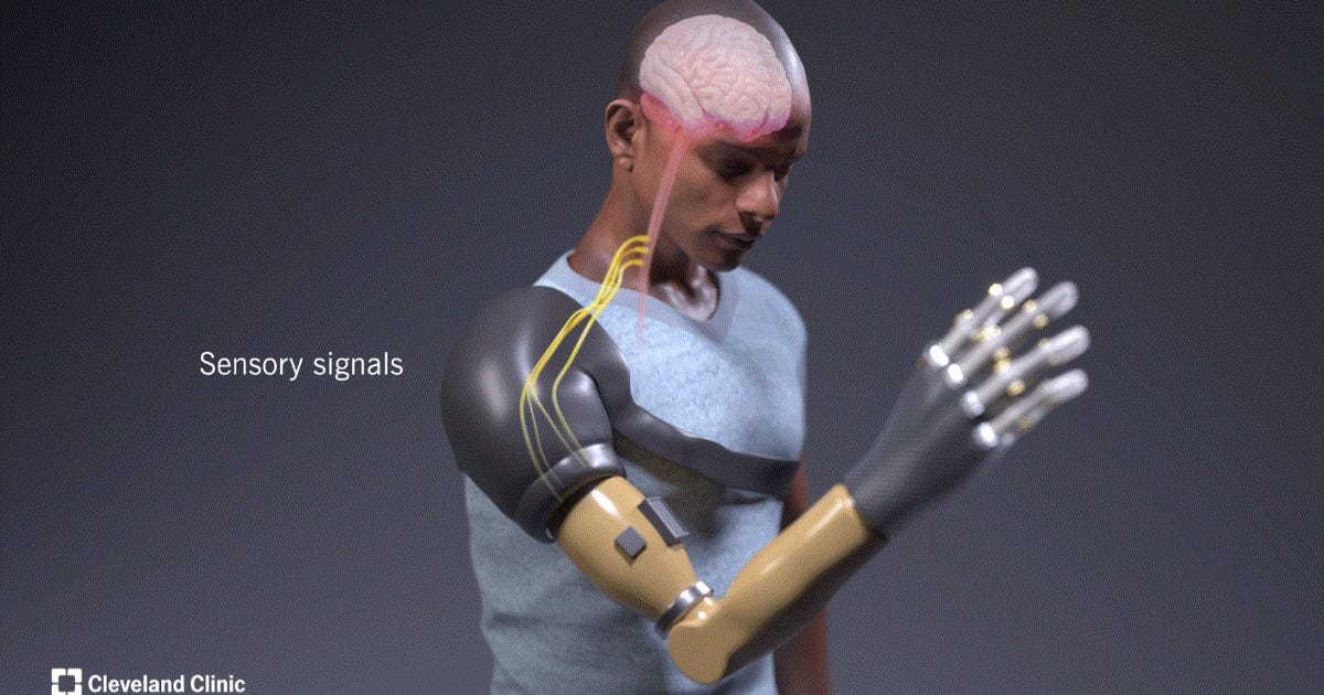 Futuristinė elektroninė ranka padeda amputuotiesiems pajusti prisilietimą ir judesį