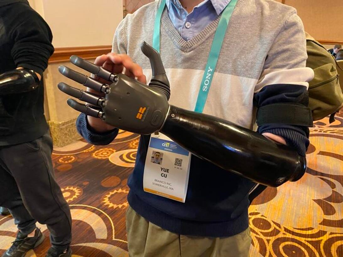 You can move this prosthetic hand with your mind