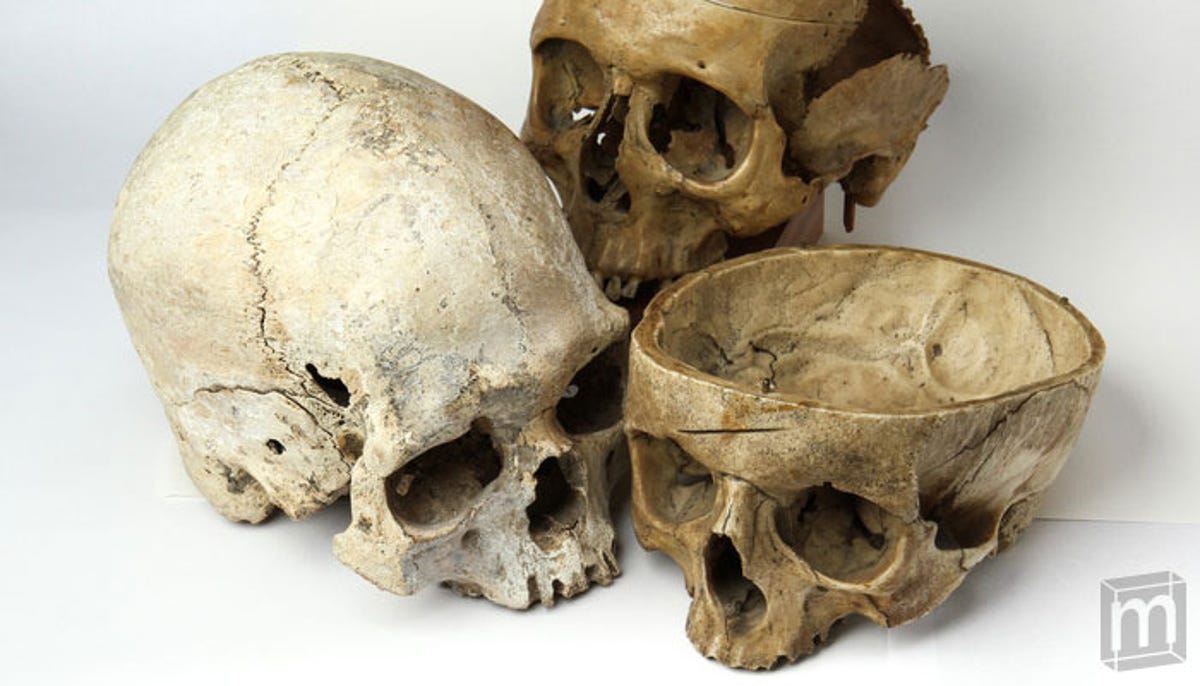 The human skull is made up of 44 separate bony elements, and a small segment of one is included in the Mini Museum.