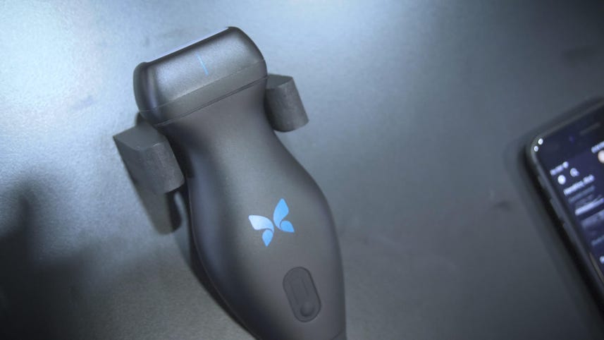 CES 2019: Take your own ultrasound with Butterfly iQ’s handheld scanner
