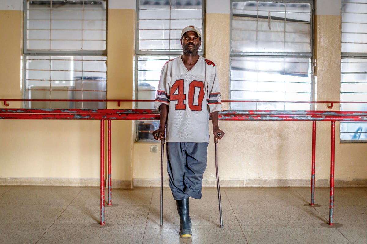 Abel Mbussolo still waits for a prosthetic leg after his first one was destroyed in a house fire. In 2012, he stepped on a trip wire while walking to farm his crops.