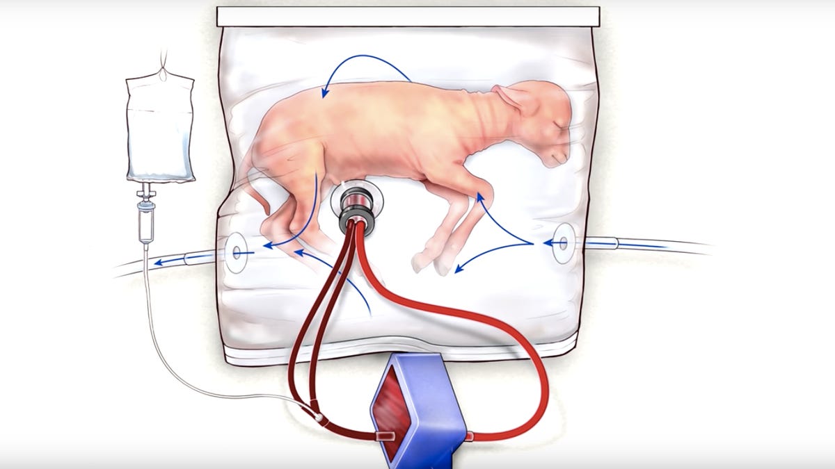 artificial-womb.png