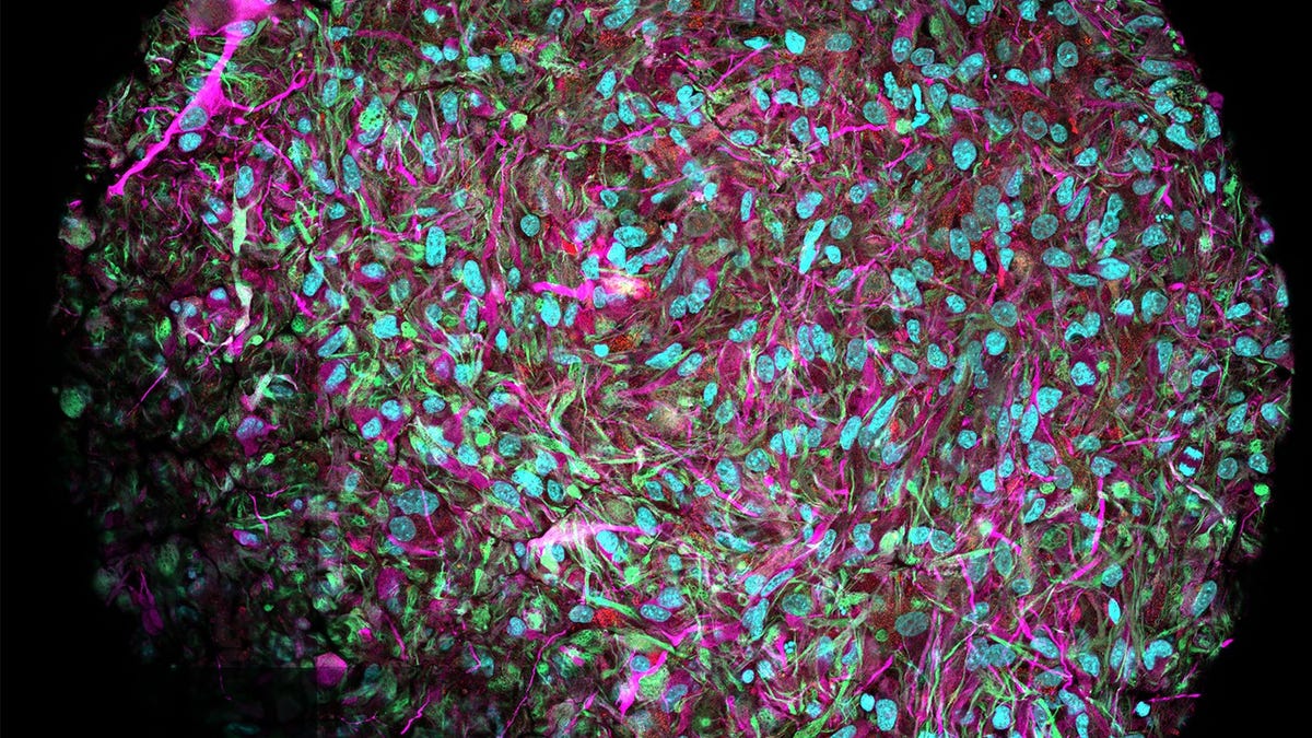 Multi-colored cells and neurons.
