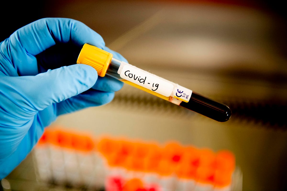 COVID-19 blood sample