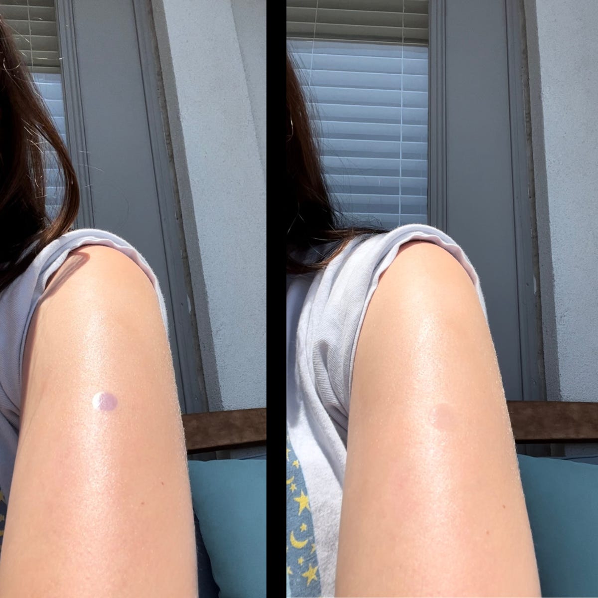 Four UV stickers on upper legs in the sun
