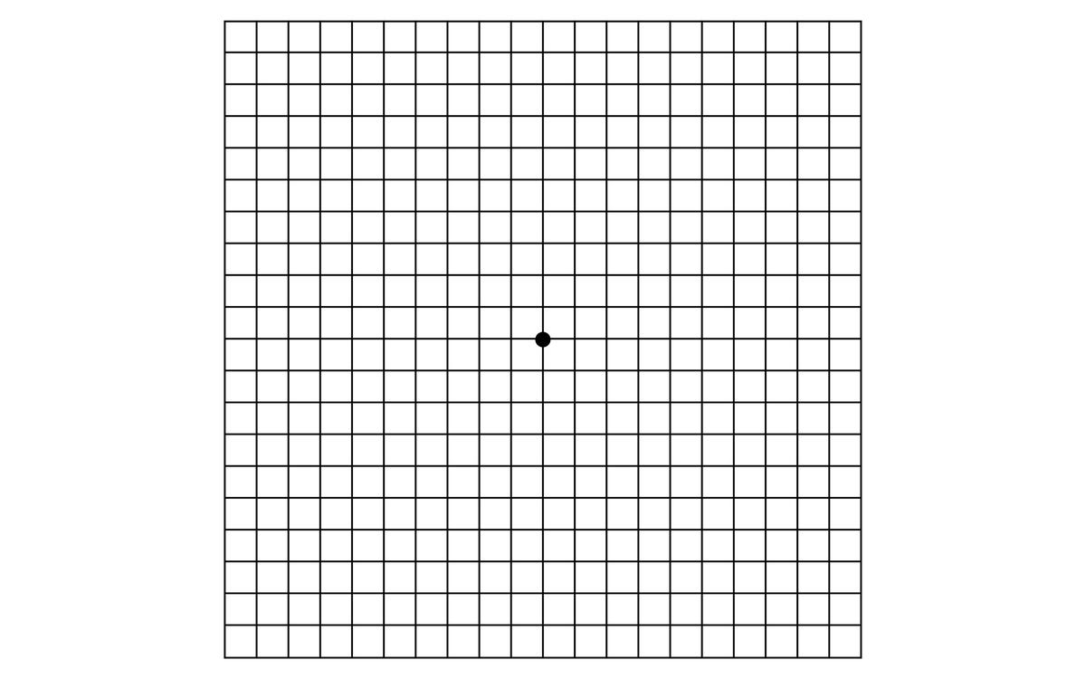 An Amsler grid: a grid with a dot in the middle.