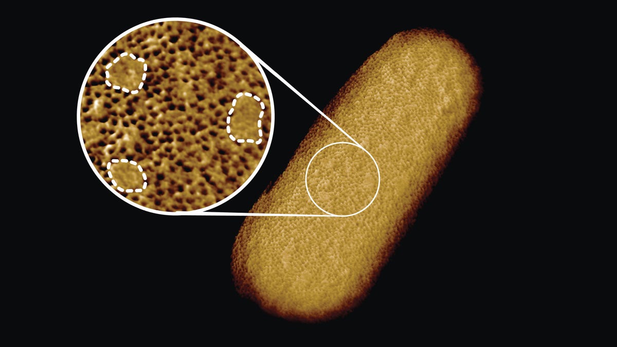 Image of E Coli with inset image signifying regions of membrane that lack proteins