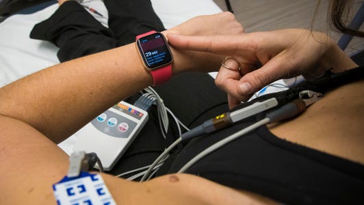 Apple Watch electrocardiogram EKG