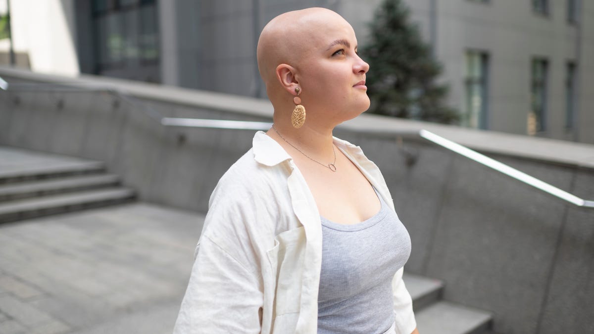 a woman with alopecia