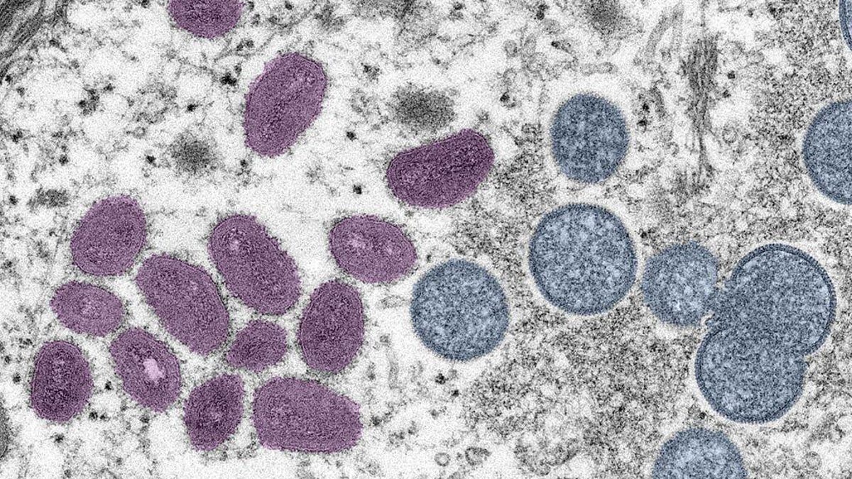 A monkeypox virus particle under the microscope.