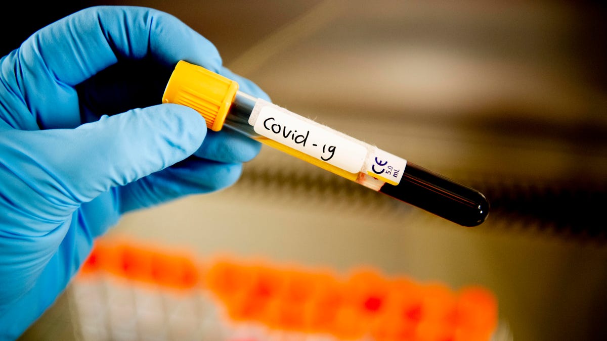 COVID-19 blood sample
