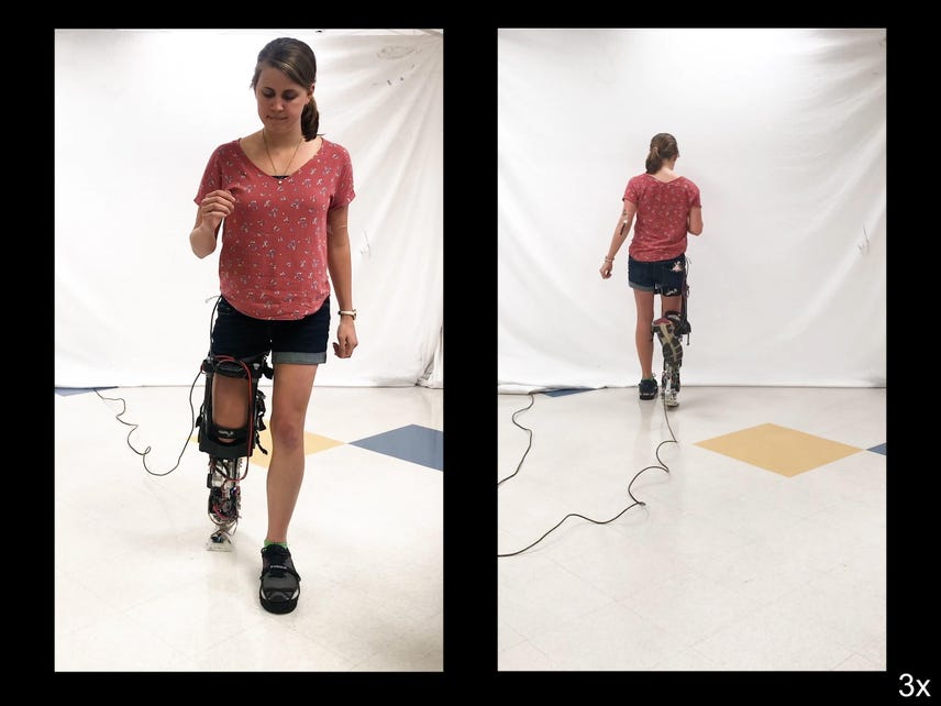 Watch this sweat-powered wearable control a prosthetic leg