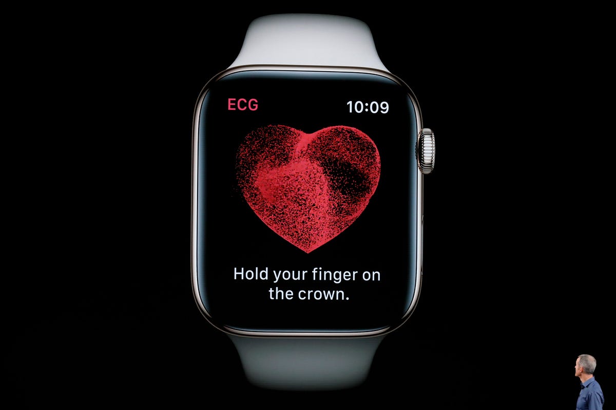 Apple Watch Series 8 displays an ECG message