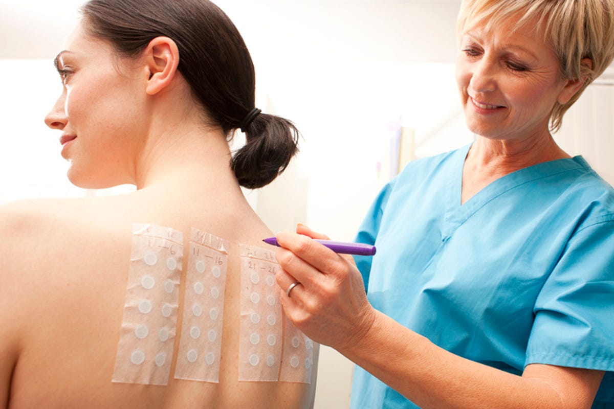 Doctor performing a patch allergy test on a woman's back
