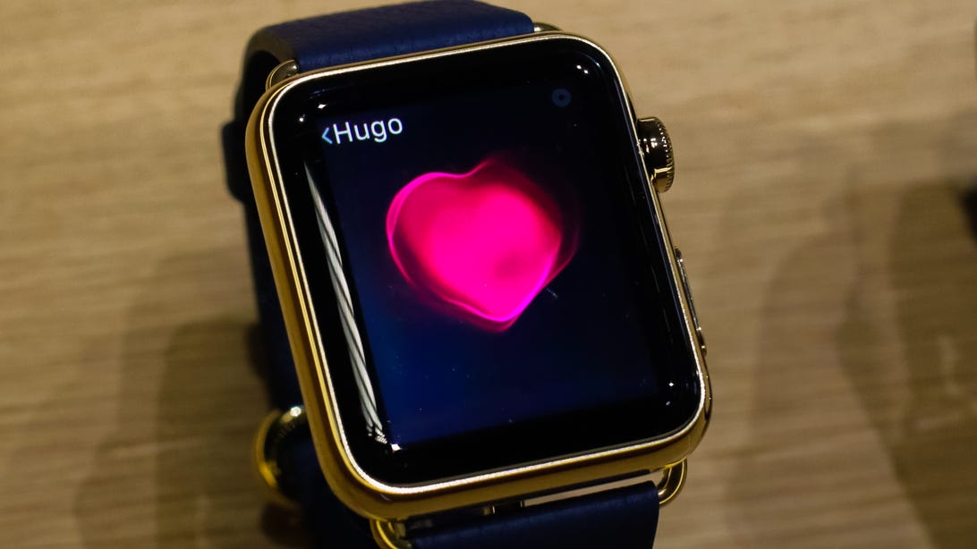 The Apple Watch may have saved a teen’s life