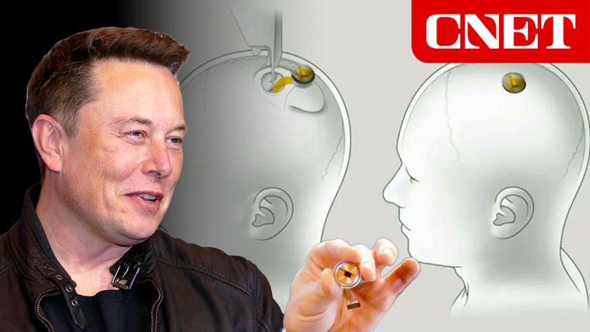 Neuralink Explained: Elon Musk Plans to Tap Our Minds With Brain Implants
