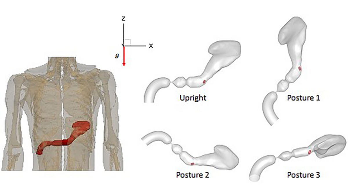 On the left is a diagram showing what the stomach looks like when a person is standing, and on the right how it's oriented in the various postures considered in the study.