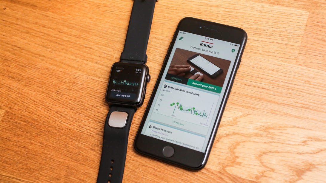 07-alivecor-kardia-band-for-apple-watch
