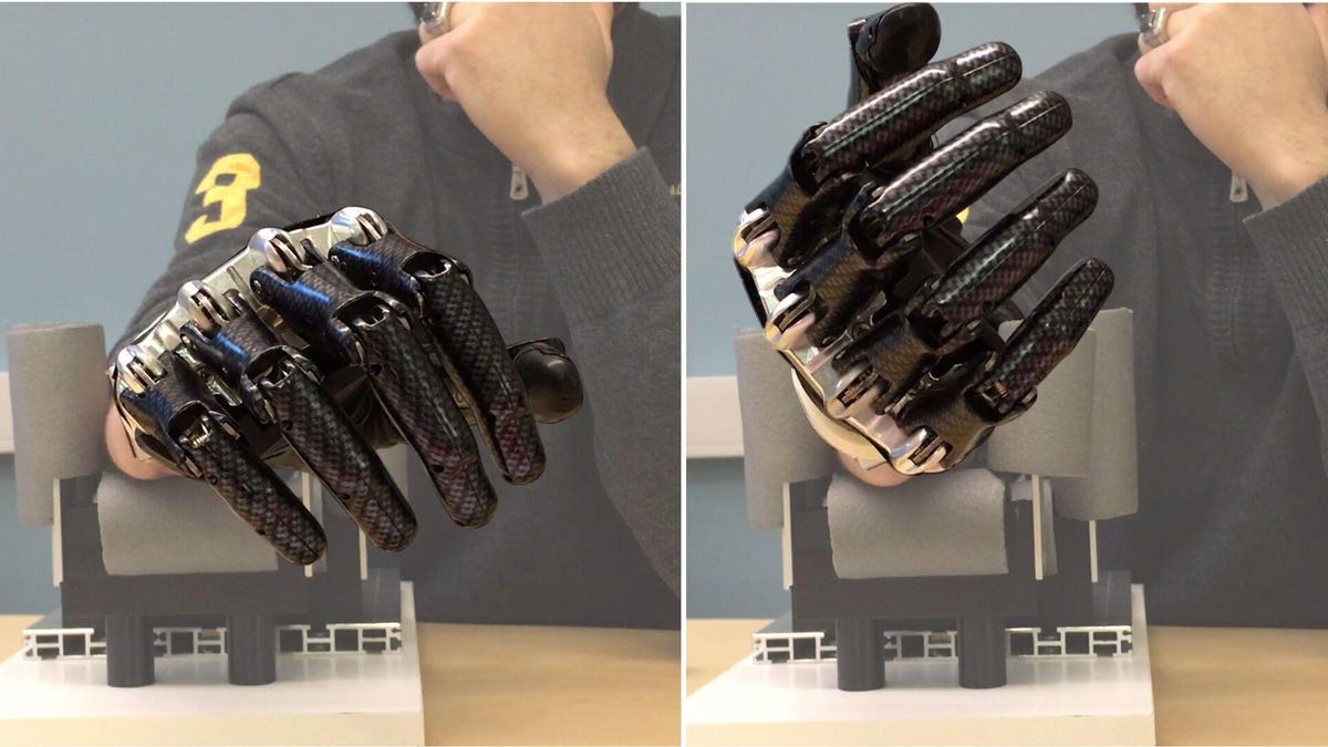 Futuristic bionic arm helps amputees feel the sensation of touch and  movement - CNET