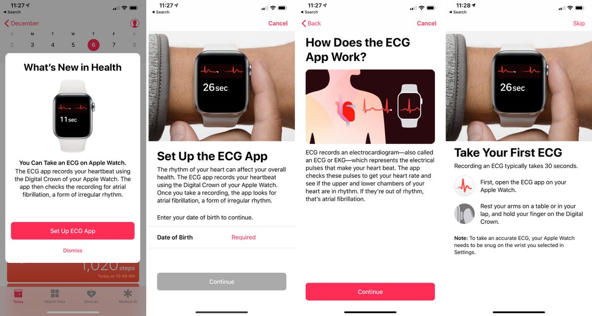 apple-watch-ecg-setup-health-app