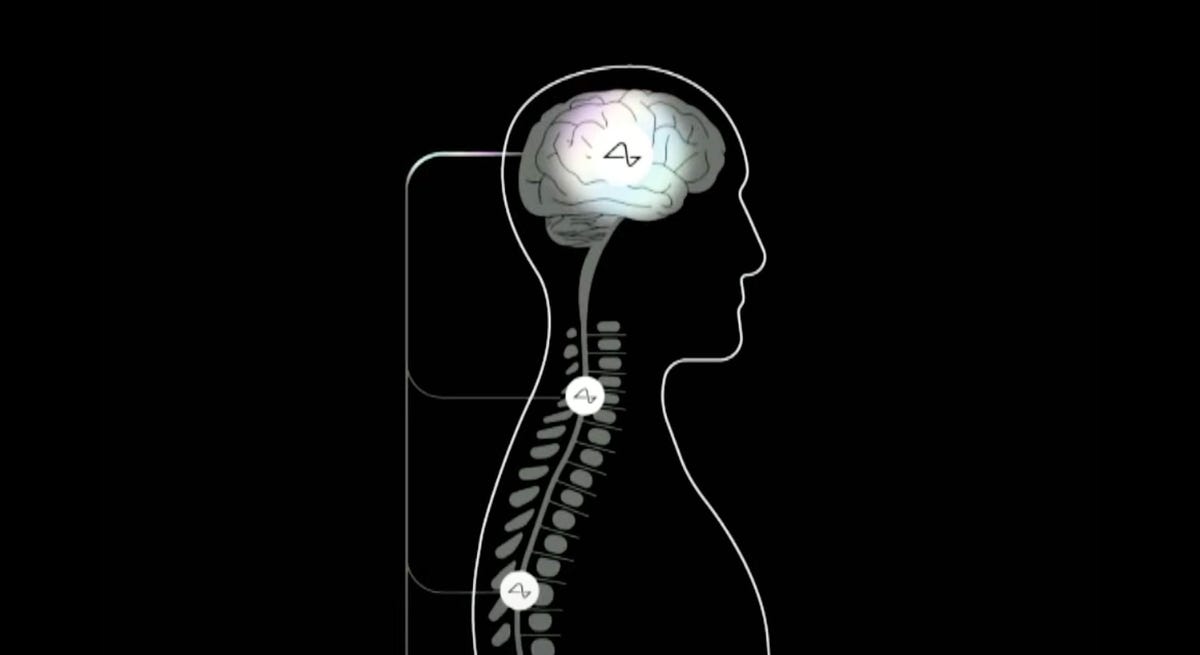 A diagram of the Neuralink connection between a person's brain and spinal cord