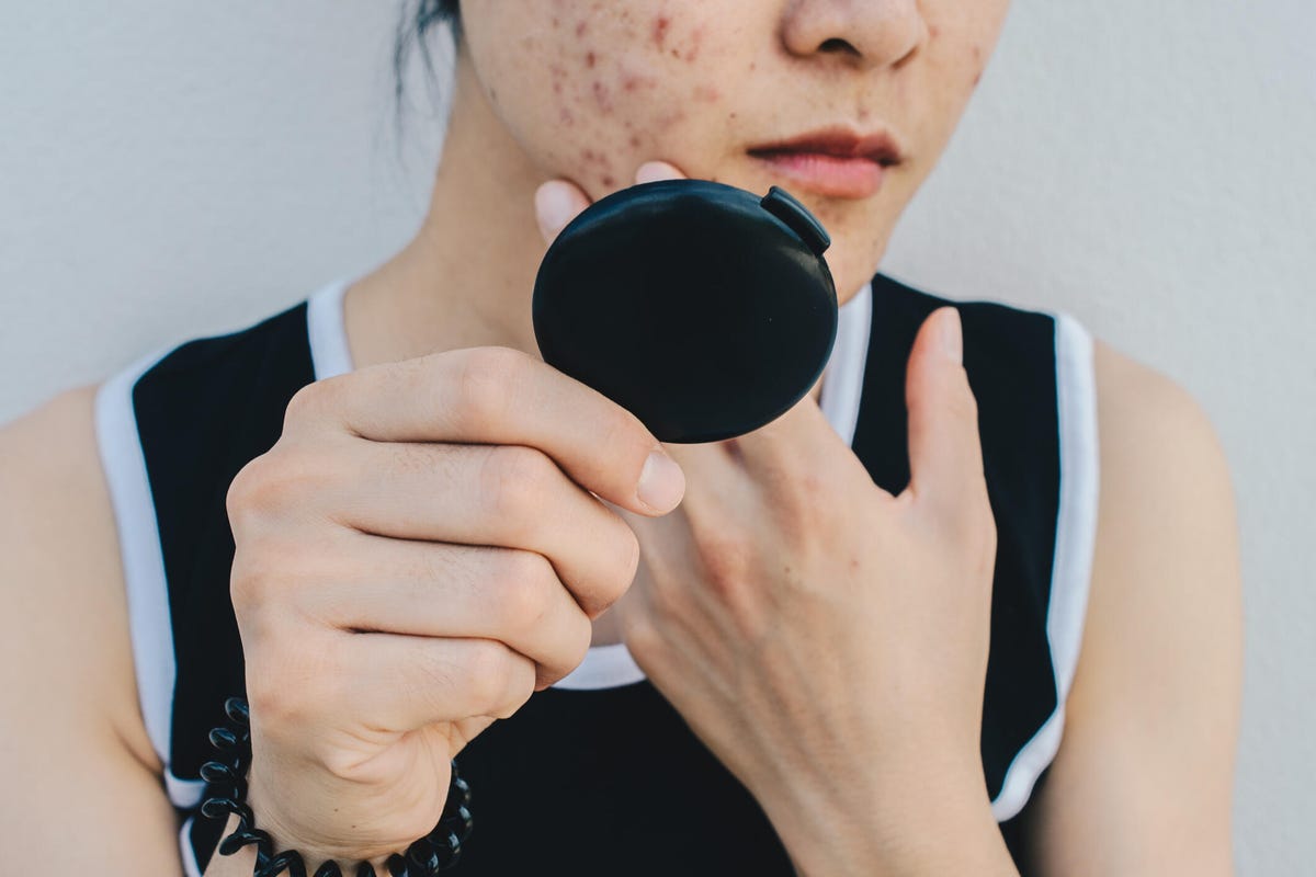 Close up of Asian woman worry about her face when she saw the problem of acne and scar by the mini mirror. - stock photo