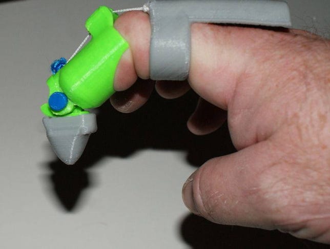 3D-printed fingertip early design