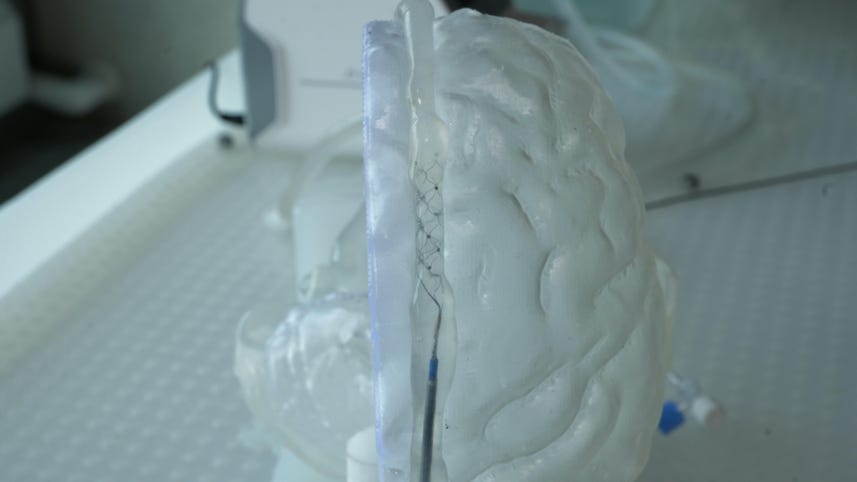 Brain-Computer Interface: No Open Brain Surgery Required