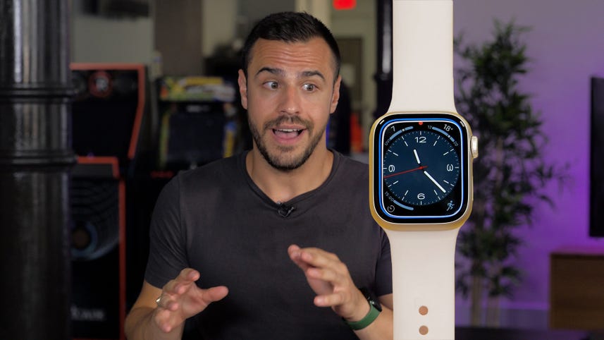 Next Apple Watch Must-Haves