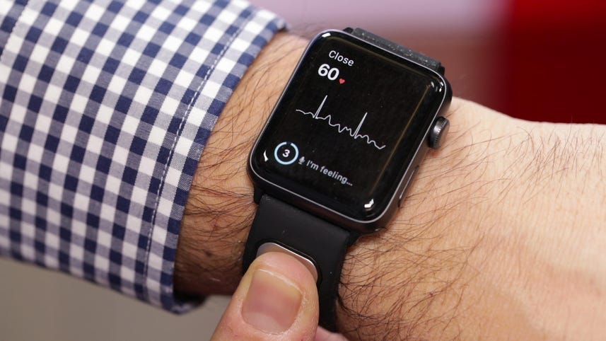 Apple Watch gets FDA-cleared heart rate sensor: Hands-on with Kardia Band