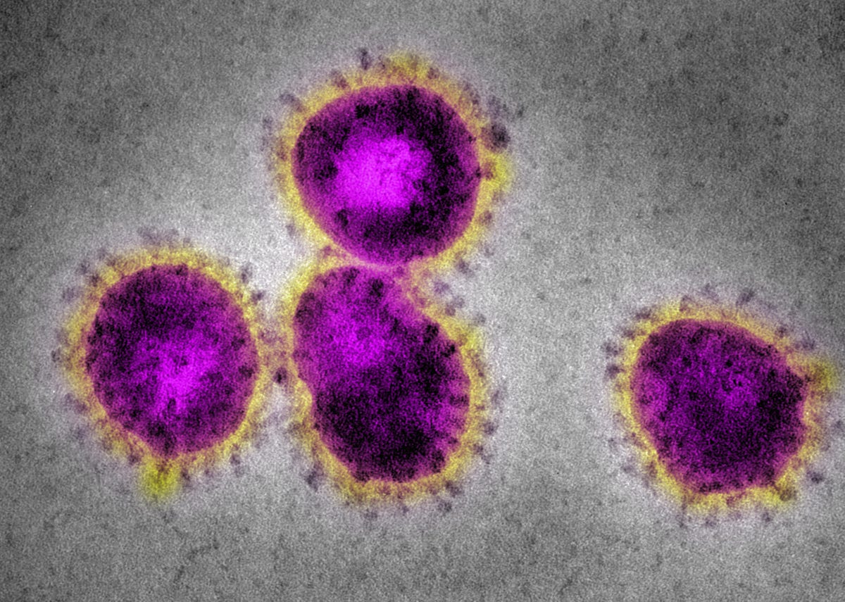 Coronavirus that causes SARS, seen in an electron microscope