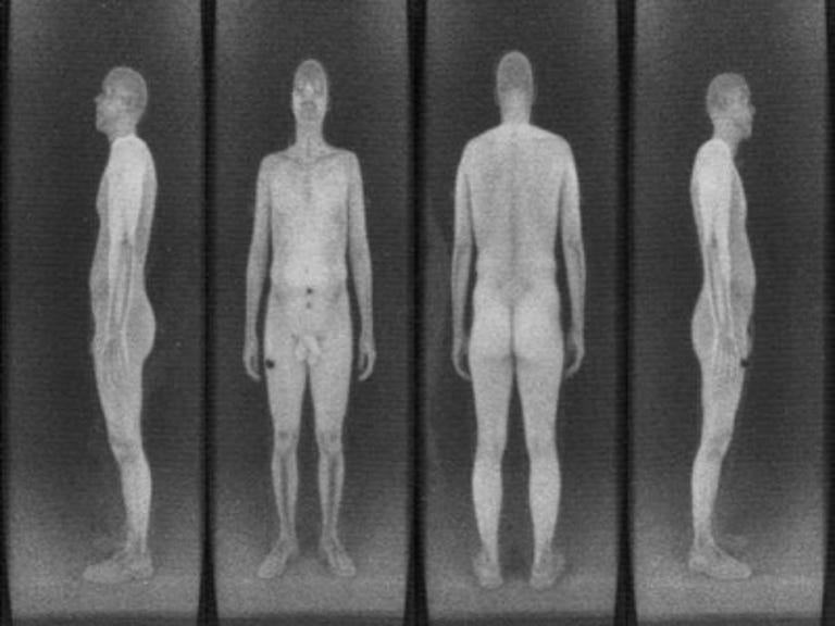 This image of an adult man was taken using a Rapiscan Secure 1000 backscatter X-ray scanner.