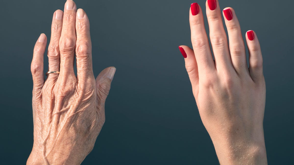 old and young skin as seen on two hands