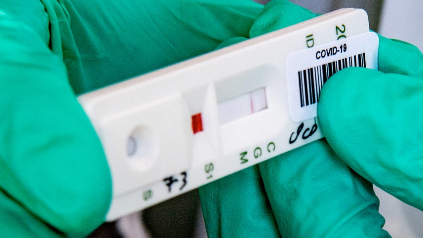 Testing the accuracy of coronavirus antibody tests